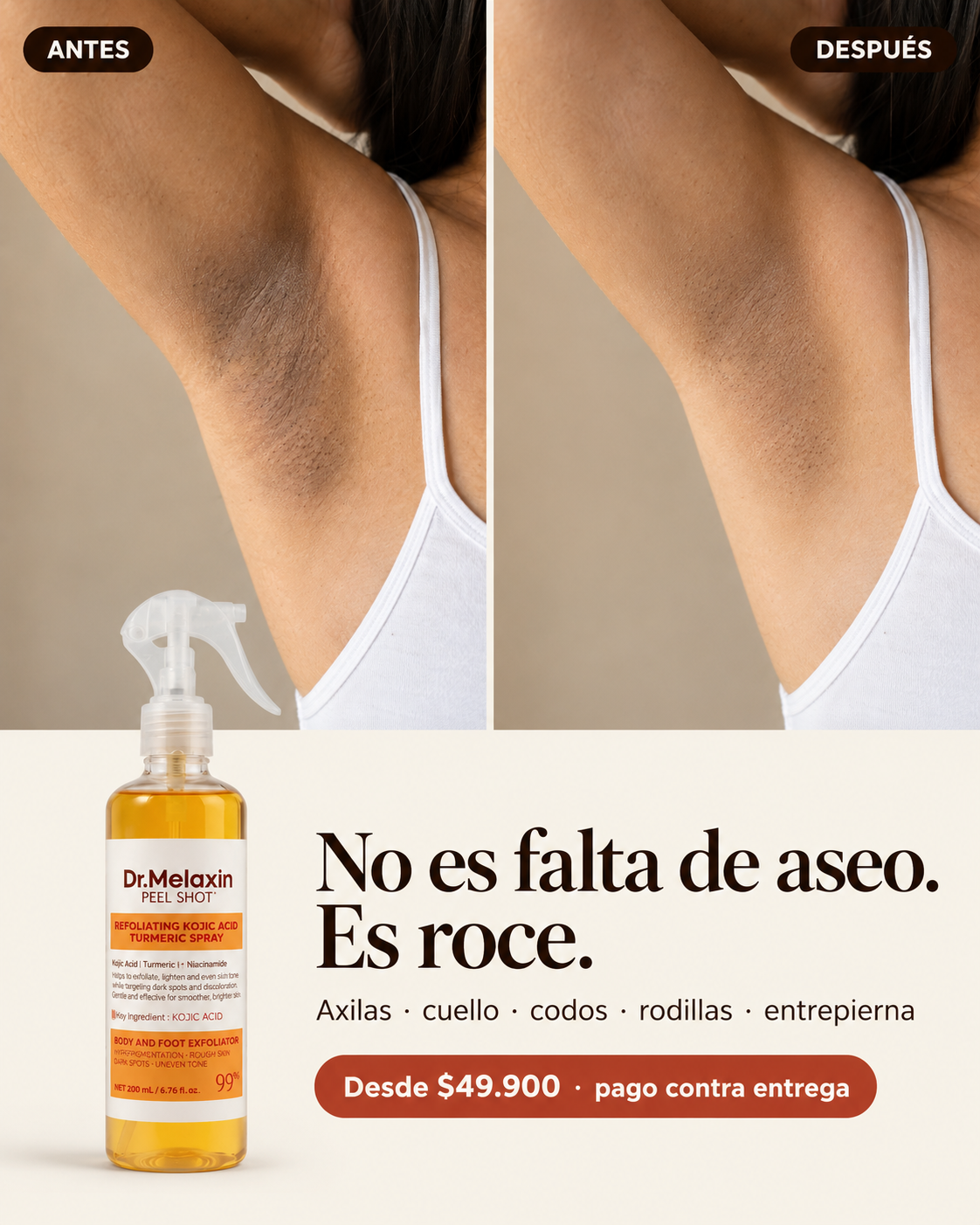 Comparación ilustrativa de la zona axilar antes y después del uso continuo de Peel Shot TX